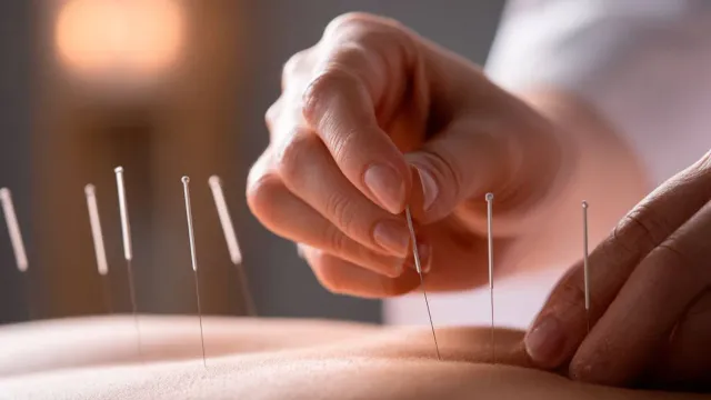 Названы виды боли, от которых помогает иглоукалывание