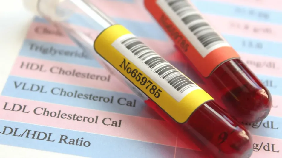 Ученые нашли способ спрогнозировать инфаркт и инсульт задолго до начала