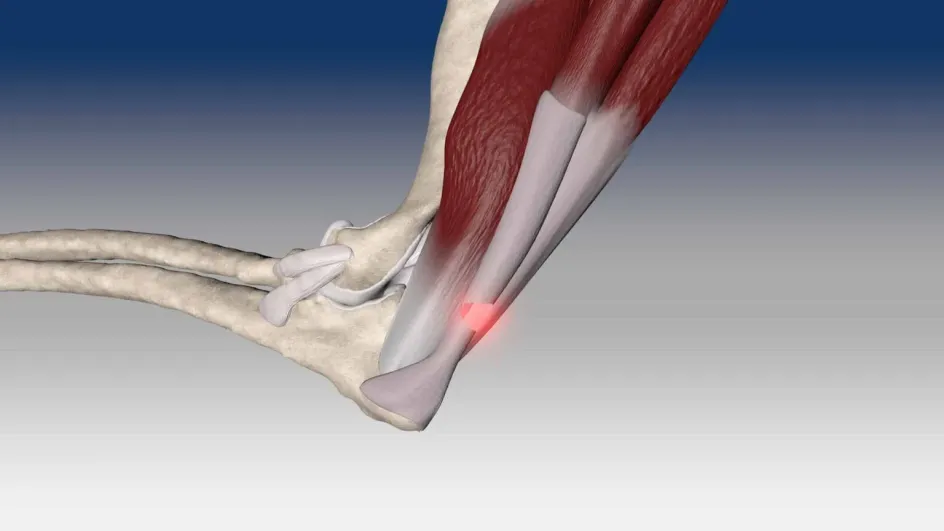 Учёные нашли главный фактор болезни сухожилий