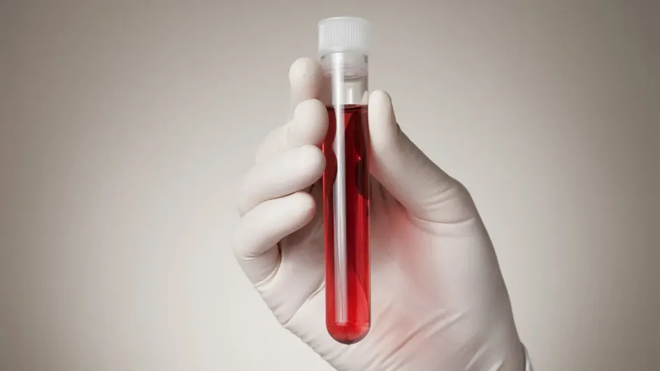 Названа группа крови, носители которой отличаются высоким интеллектом Названа группа крови, носители которой отличаются высоким интеллектом