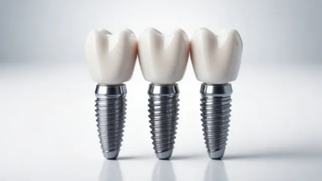 Врач рассказал, как часто нужно менять зубные импланты