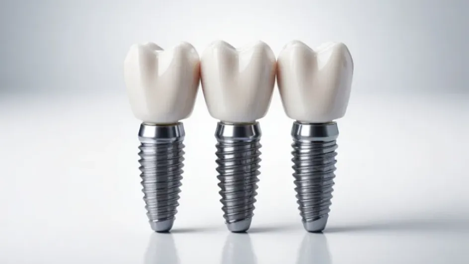 Врач рассказал, как часто нужно менять зубные импланты