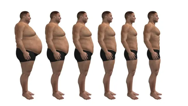 BMJ Open: люди с 2-3 степенью ожирения чаще страдают от дефицита витамина D