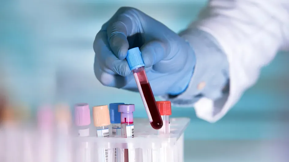 Врач назвал анализы, которые нужно сдавать каждый год