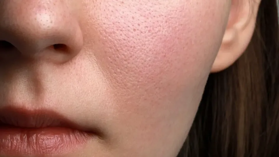 Россиянам рассказали, как с помощью генов улучшить состояние кожи