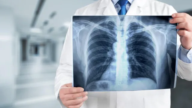 Врач рассказала, сколько раз в год можно делать флюорографию и рентген