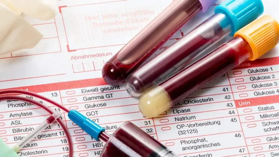 Ученые разработали тест для определения выживаемости при раке легких по анализу крови