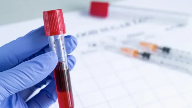 Новая методика анализа крови позволит выявить рак яичников на ранней стадии