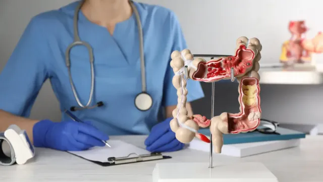 Горячая новость | Назван простой способ снизить воспаление в кишечнике