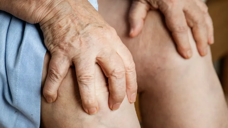 Россиянам рассказали, какие суставы обычно страдают при артрите Россиянам рассказали, какие суставы обычно страдают при артрите
