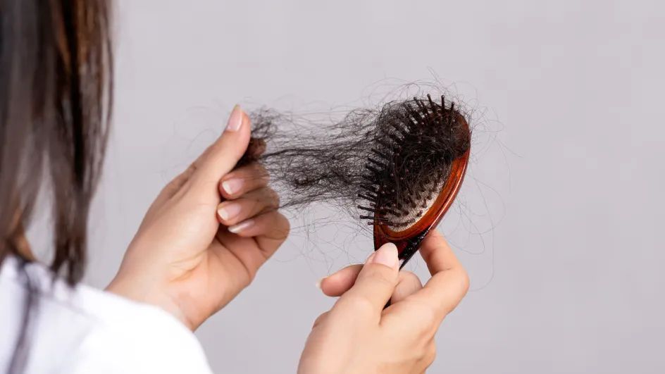 Стало известно, дефицит каких веществ может вызвать выпадение волос