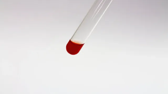 Найден метод, который позволяет выявлять рак за три года до признаков