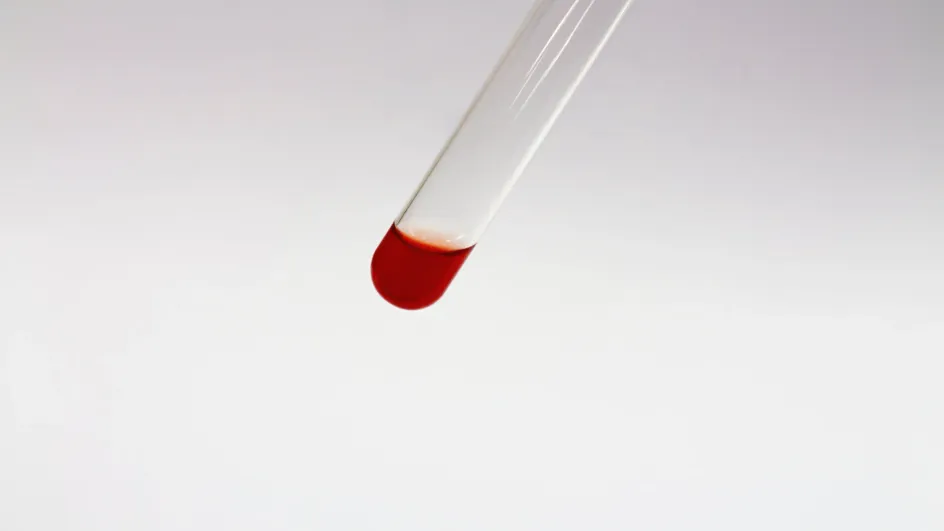 Найден метод, который позволяет выявлять рак за три года до признаков