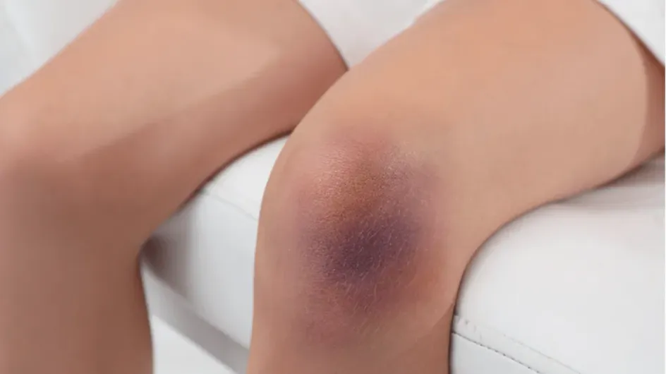 Найдена конкретная группа людей, у которых медленнее заживают раны