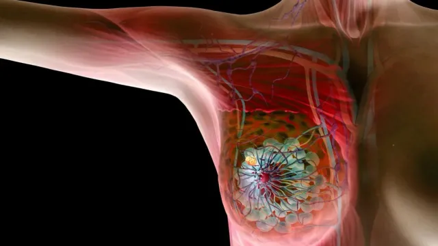 Названы продукты, которые снижают риск развития рака груди