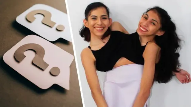 Today: сиамские близняшки Кармен и Люпита из США имеют один половой орган на двоих и ходят на...