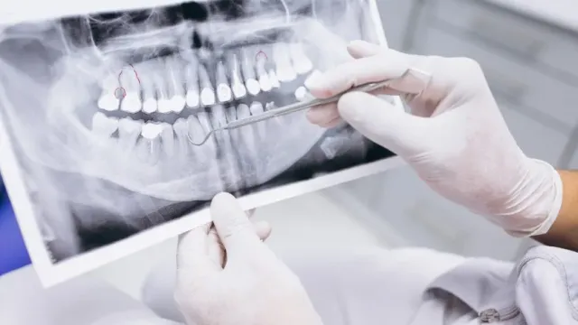 Science: в Японии учёные нашли способ выращивать новые зубы вместо утраченных