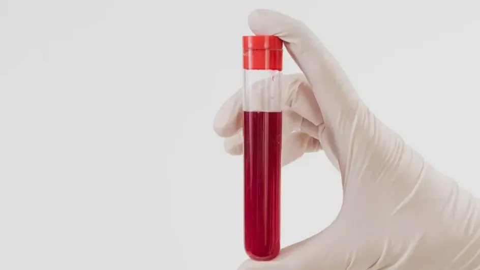 Ученые нашли неочевидную причину нарушения работы иммунной системы Ученые нашли неочевидную причину нарушения работы иммунной системы