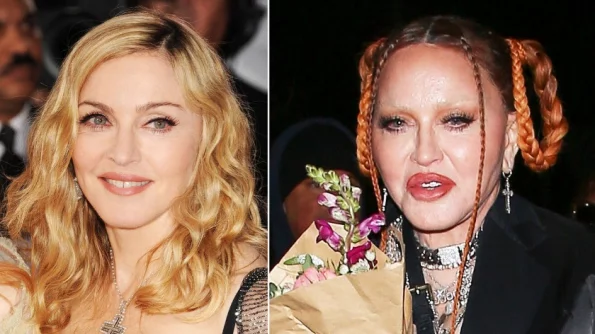 Мадонна ужаснула поклонников изменениями лица