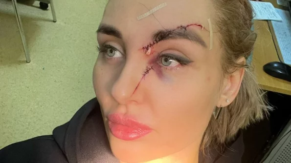 В Твери в ресторане женщина напала на посетительницу и порезала ей лицо разбитым бокалом