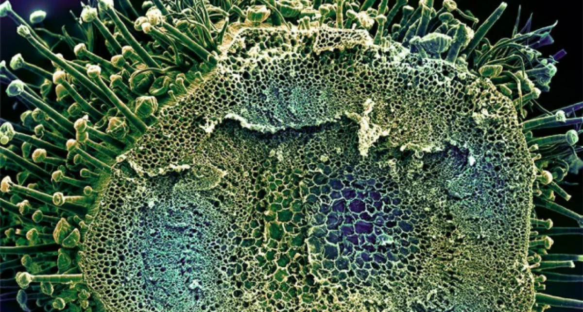 Коронавирус весной 2020 года. Ковид 19. Вирус ковид. Коронавирус под микроскопом. Вирус ковид под микроскопом.