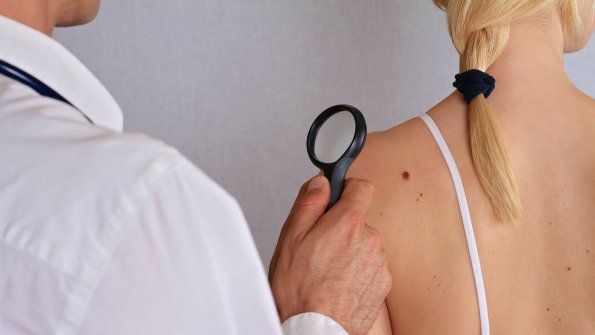Онколог рассказал о незаметных признаках возникновения рака кожи