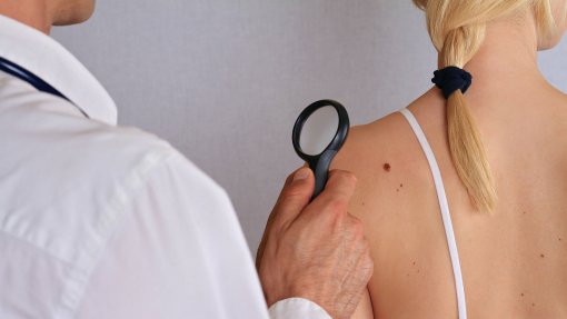 Онколог рассказал о незаметных признаках возникновения рака кожи