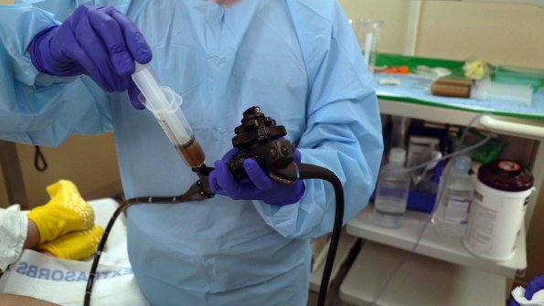 В Польше пациентов с COVID-19 вылечили с помощью пересадки кала