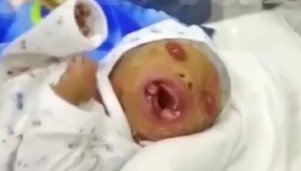 Появилось видео больного младенца, которого девушка родила от двоюродного брата