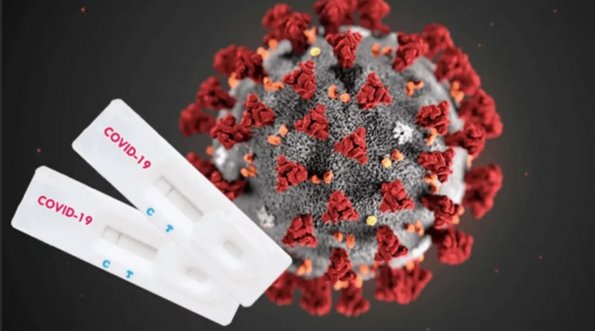 «Инвитро» сообщило о новом тесте на показатель авидности антител к SARS-CoV-2