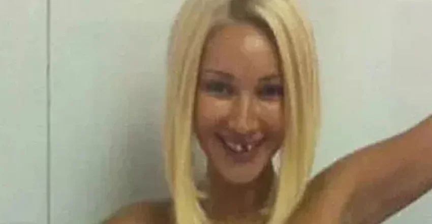 Щербатая и без косметики: Лера Кудрявцева показала себя без макияжа и с выбитым зубом