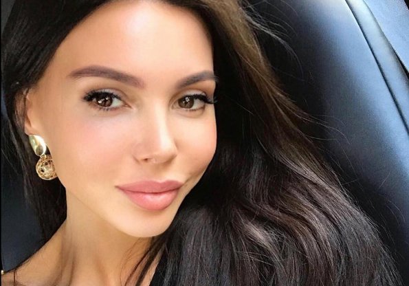 33-летняя модель Оксана Самойлова решила уменьшить губы и получила отек