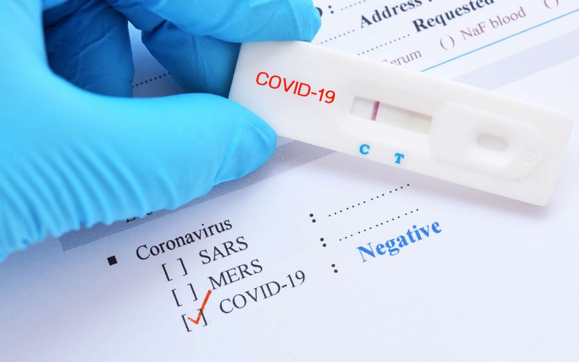 Пациентов в России смогут выписывать после одного отрицательного теста на коронавирус