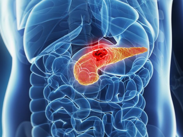Британские врачи назвали 3 проблемы с ЖКТ, являющиеся признаками рака поджелудочной железы