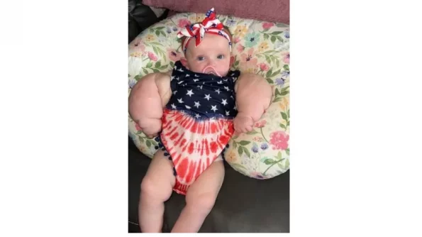 В Америке родился младенец с руками "бодибилдер"